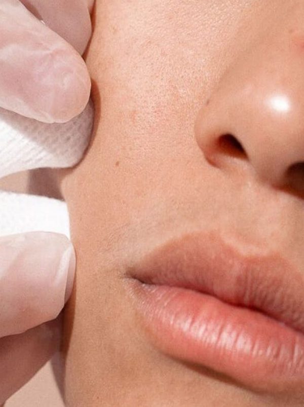 30 Minute Skin Consultation