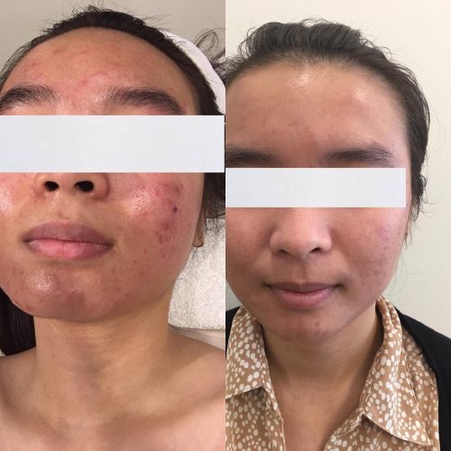 vaiabeauty_7 weeks